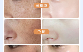 美白淡斑效果好的护肤品排行榜2026新版发布，如何根据肤质年龄和需求科学选择产品